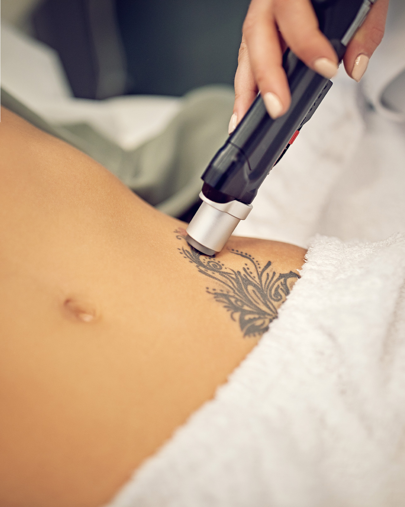 Borrar tatuajes